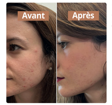Charger l'image dans la galerie, Sérum Anti-Imperfections Comme Avant